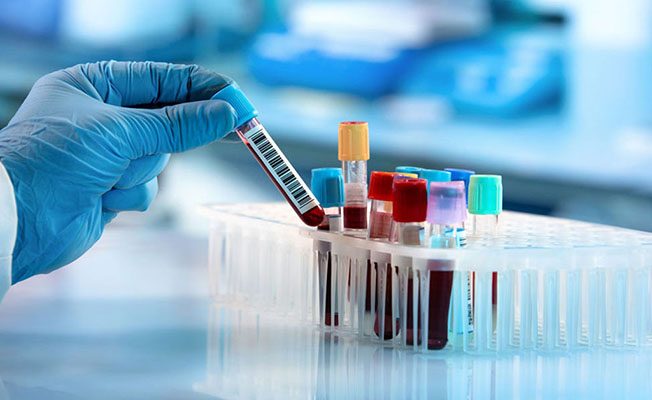 imagen especialidad laboratorio centro de salud en curauma